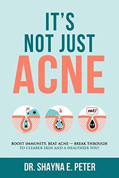 portada It'S not Just Acne: Boost Immunity, Beat Acne - Break Through to Clearer Skin & a Healthier You! Boost Immunity, Beat Acne - Break Through to Clearer Skin & a Healthier You! (en Inglés)