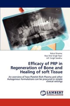 portada efficacy of prp in regeneration of bone and healing of soft tissue (en Inglés)