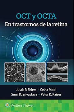 portada Oct Y Octa En Trastornos de la Retina (in Spanish)