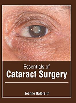 portada Essentials of Cataract Surgery (en Inglés)