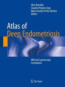 portada Atlas of Deep Endometriosis: MRI and Laparoscopic Correlations (en Inglés)