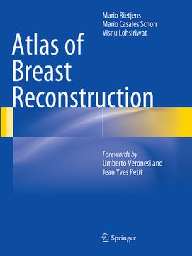 portada Atlas of Breast Reconstruction (in English)
