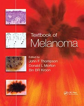 portada Textbook of Melanoma: Pathology, Diagnosis and Management 