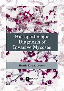 portada Histopathologic Diagnosis of Invasive Mycoses (en Inglés)