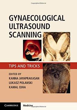 portada Gynaecological Ultrasound Scanning: Tips and Tricks (en Inglés)