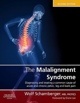 portada the malalignment syndrome
