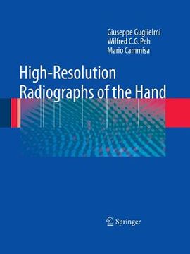 portada high-resolution radiographs of the hand (en Inglés)
