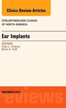 portada Ear Implants, an Issue of Otolaryngologic Clinics of North America (Volume 47-6) (The Clinics: Internal Medicine, Volume 47-6)