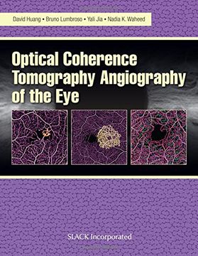 portada Optical Coherence Tomography Angiography of the Eye