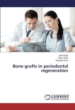 portada Bone grafts in periodontal regeneration