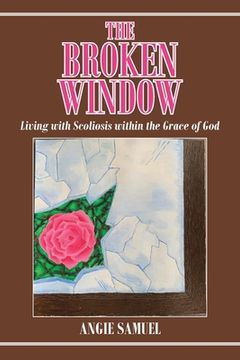portada The Broken Window: Living with Scoliosis within the Grace of God (en Inglés)