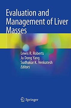 portada Evaluation and Management of Liver Masses