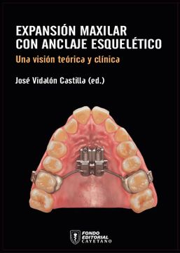 portada Expansión maxilar con anclaje esquelético (in Spanish)