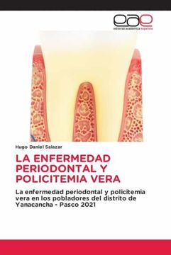 portada La Enfermedad Periodontal y Policitemia Vera
