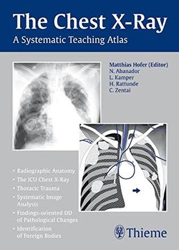 portada The Chest X-Ray: A Systematic Teaching Atlas (in English)