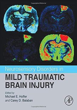 portada Neurosensory Disorders in Mild Traumatic Brain Injury (en Inglés)