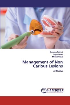 portada Management of Non Carious Lesions (en Inglés)