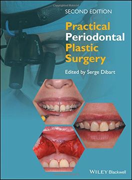portada Practical Periodontal Plastic Surgery