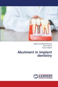 portada Abutment in implant dentistry (in English)