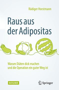 portada Raus aus der Adipositas: Warum diã Â¤Ten Dick Machen und die Operation ein Guter weg ist (German Edition) Paperback (in German)