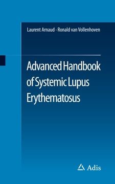 portada Advanced Handbook of Systemic Lupus Erythematosus (in English)