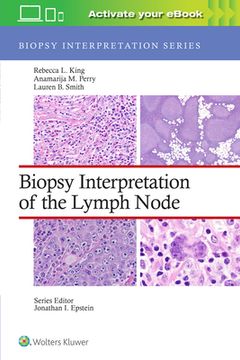 Biopsy Interpretation of the Lymph Node: Print + Ebook With Multimedia (Biopsy Interpretation Series) (en Inglés)