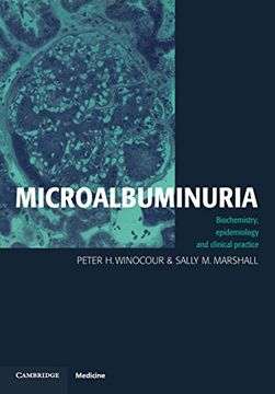 portada Microalbuminuria: Biochemistry, Epidemiology and Clinical Practice (en Inglés)