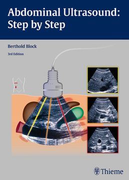 portada Abdominal Ultrasound: Step by Step (en Inglés)