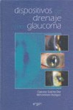 portada Dispositivos de Drenaje Para Glaucoma (in Spanish)