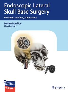 portada Endoscopic Lateral Skull Base Surgery: Principles, Anatomy, Approaches (in English)