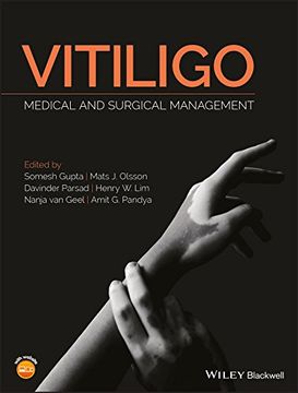 portada Vitiligo: Medical and Surgical Management (en Inglés)