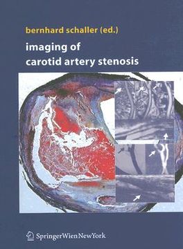 portada Imaging of Carotid Artery Stenosis (en Inglés)