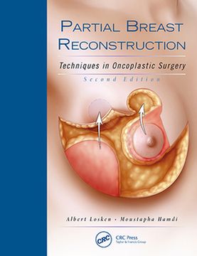 Partial Breast Reconstruction: Techniques in Oncoplastic Surgery (en Inglés)