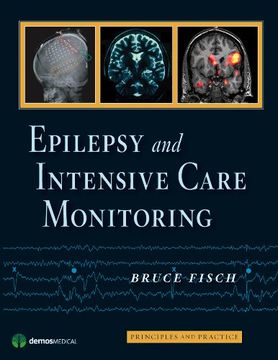 portada Epilepsy and Intensive Care Monitoring: Principles and Practice 