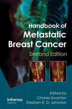 portada Handbook of Metastatic Breast Cancer (in English)