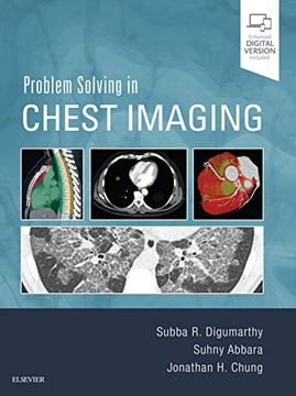 portada Problem Solving in Chest Imaging (in English)