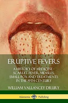 portada Eruptive Fevers: A History of Medicine - Scarlet Fever, Measles, Small-Pox and Treatments in the 19Th Century (in English)
