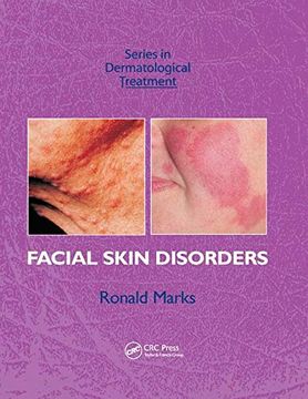 portada Facial Skin Disorders (Series in Dermatological Treatment) (en Inglés)