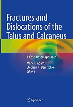 portada Fractures and Dislocations of the Talus and Calcaneus: A Case-Based Approach (en Inglés)