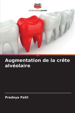 portada Augmentation de la crête alvéolaire (in French)