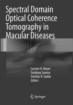 portada Spectral Domain Optical Coherence Tomography in Macular Diseases (en Inglés)