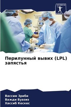 portada Перилунный вывих (LPL) запяс&# (in Russian)