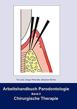 portada Arbeitshandbuch Parodontologie: Band 2 Chirurgische Therapie (en Alemán)