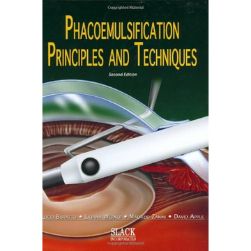 portada Phacoemulsification: Principles and Techniques