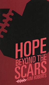 portada Hope Beyond the Scars (en Inglés)