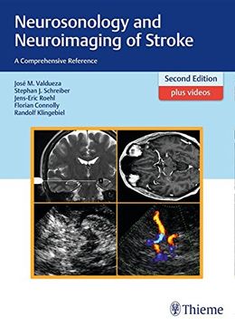 portada Neurosonology and Neuroimaging of Stroke: A Comprehensive Reference (en Inglés)