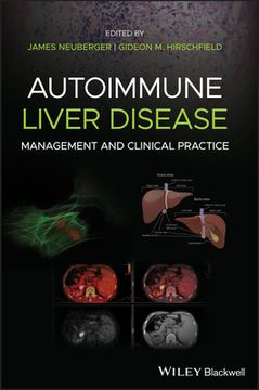 portada Autoimmune Liver Disease: Management and Clinical Practice (en Inglés)