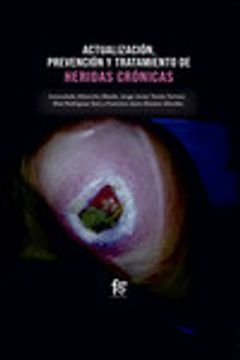 portada Actualizaciones, Prevención y Tratamiento de Heridas Crónicas (in Spanish)