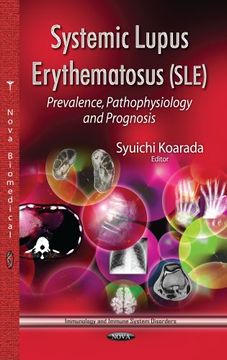 portada Systemic Lupus Erythematosus (Immunology and Immune System Disorders)