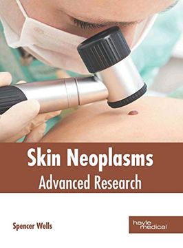 portada Skin Neoplasms: Advanced Research (en Inglés)